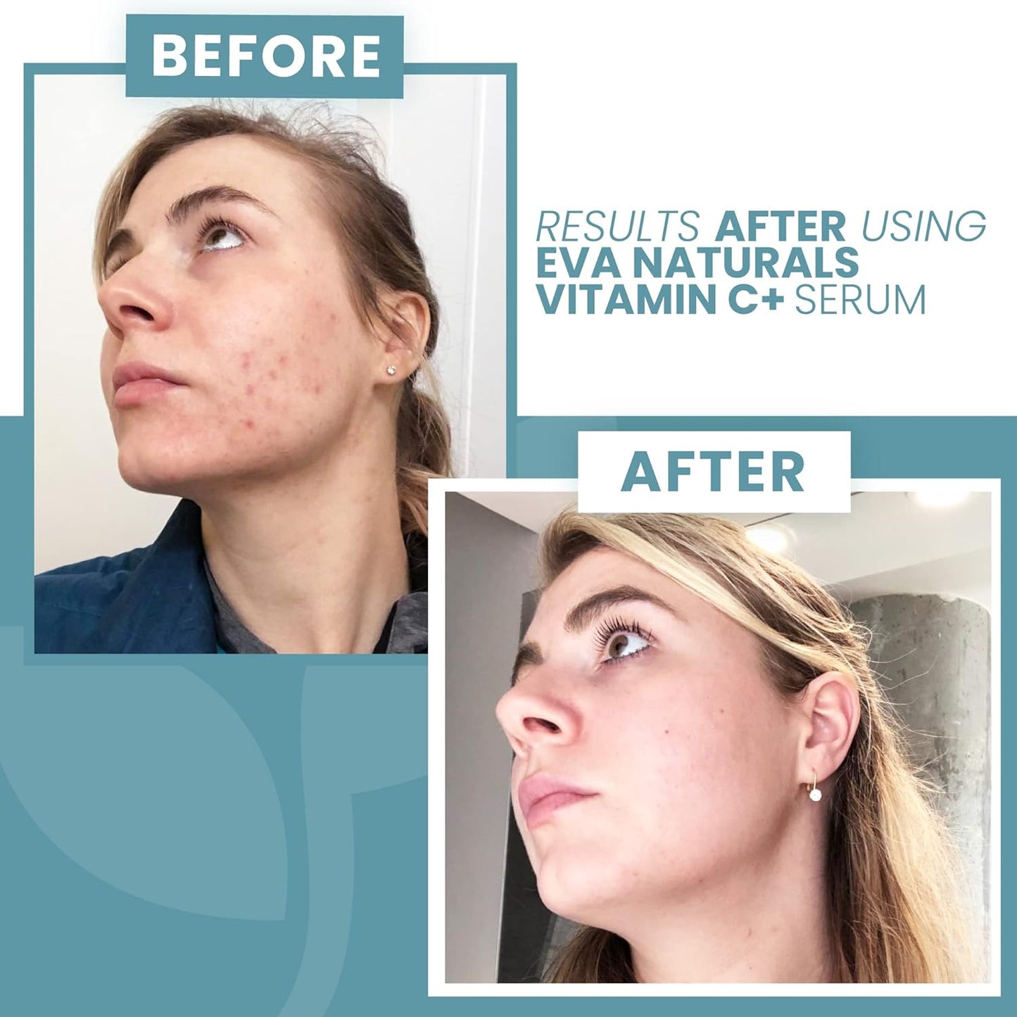 Vitamin C Face Serum With Hyaluronic Acid